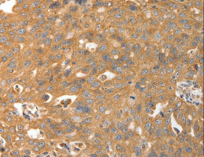 CALR / Calreticulin Antibody