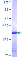 Human KRT75 / Keratin 75 / K6HF Protein (Recombinant GST, N-terminus)