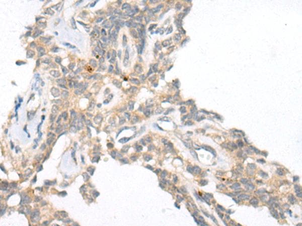 CAMK2A / CaMKII Alpha Antibody