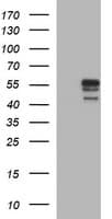 Monoclonal Mouse anti-Human MMP13 Antibody (clone OTI4B3, aa104-471, IHC, IF, WB)