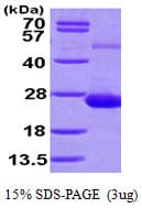 Human ADAT2 Protein (Recombinant His)