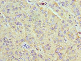 Polyclonal Rabbit anti-Human U2AF1 Antibody (aa1-240, IHC)