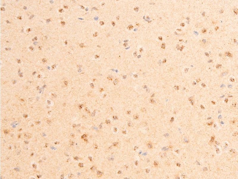 PDPK1 / PDK1 Antibody (phospho-Ser241)