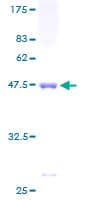 Human YKT6 Protein (Recombinant GST)