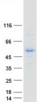 Human NEUROD1 Protein (Recombinant Myc-DDK (Flag))