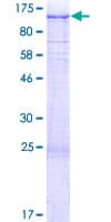 Human USP6NL Protein (Recombinant GST)