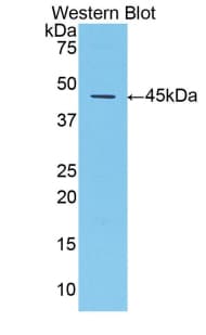 SERPINA1 / Alpha 1 Antitrypsin Antibody (aa25-413, APC)