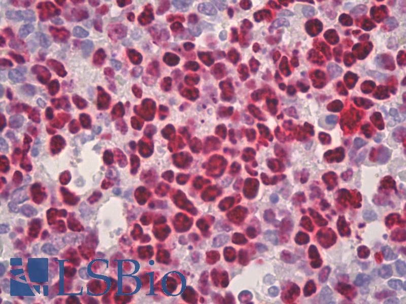 PathPlus™ Polyclonal Rabbit anti-Human MCM2 Antibody (aa1-50, IHC, IF, WB)