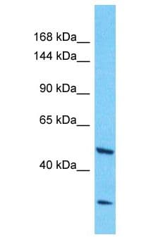 NBPF3 Antibody (aa31-80)