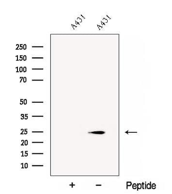 CHMP1A Antibody