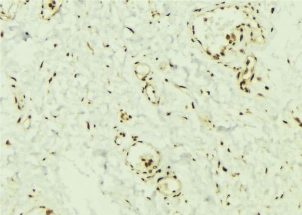 SMAD2 Antibody