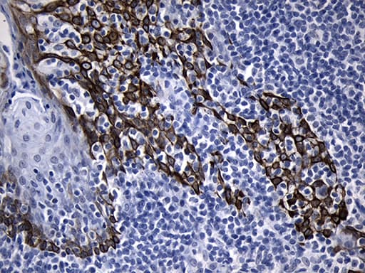 FBXO6 Antibody (clone OTI7A4)