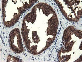 Monoclonal Mouse anti-Human Mannose Phosphate Isomerase Antibody (clone OTI1C7, Carrier-free, IHC, IF, WB)