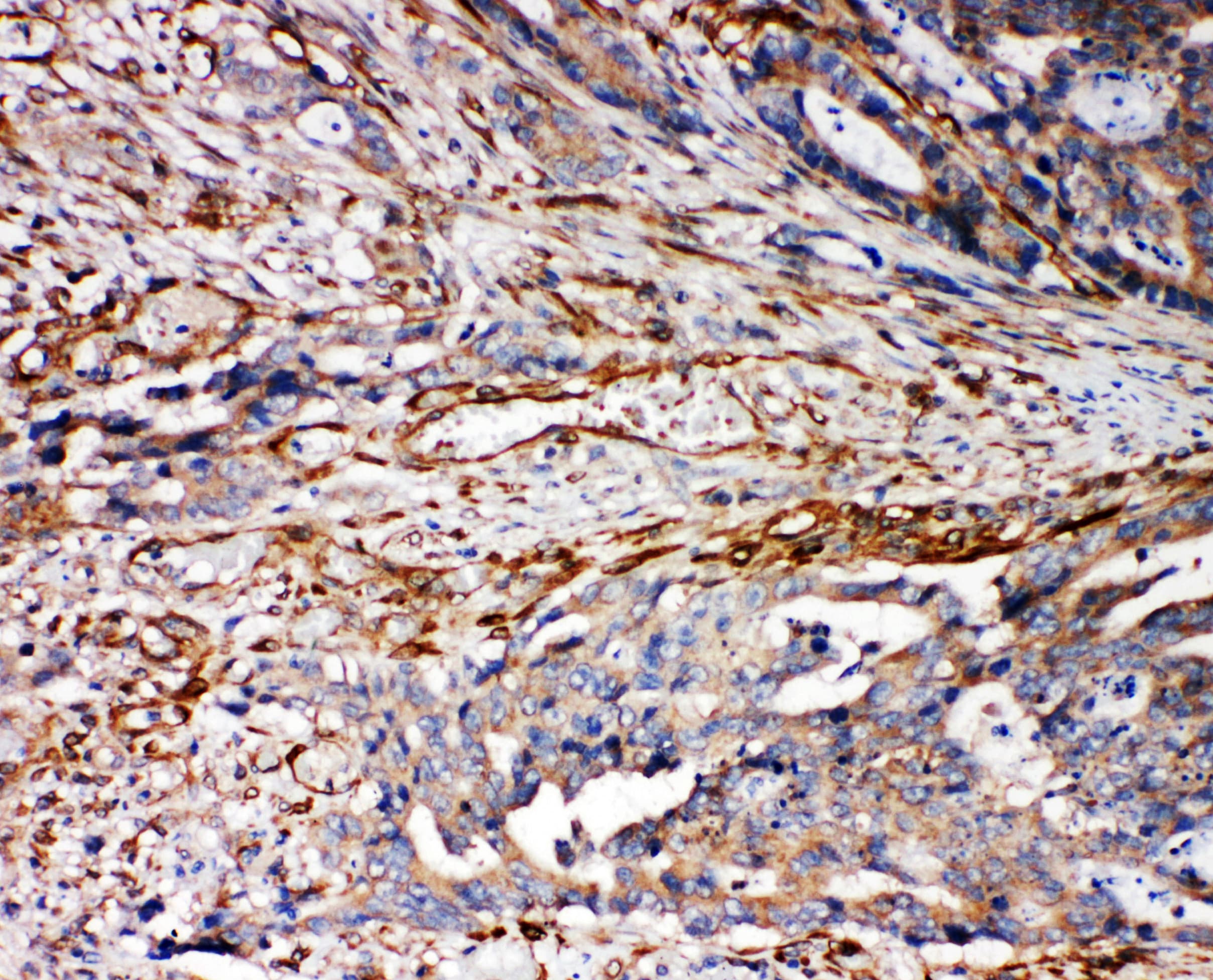 Polyclonal Rabbit anti-Human VRL1 / TRPV2 Antibody (aa42-624, IHC, WB)