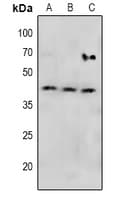 Polyclonal Rabbit anti-Human MAP2K4 / MKK4 Antibody (IHC, WB)