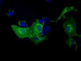 TLDC1 / KIAA1609 Antibody (clone OTI3B1)