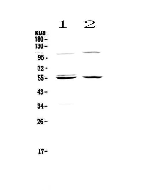 Polyclonal Rabbit anti-Human CASP8 / Caspase 8 Antibody (WB)