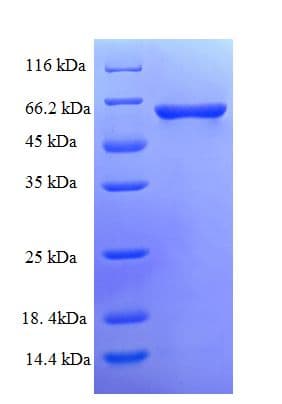 Human PPP3CC / CALNA3 Protein (Recombinant His)