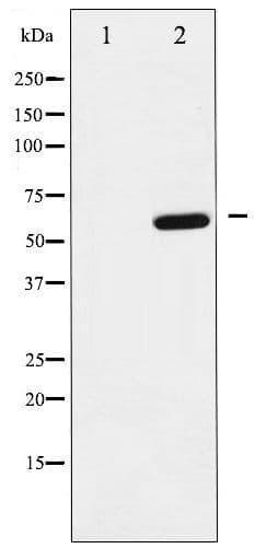 Polyclonal Rabbit anti-Human DOK1 Antibody (phospho-Tyr398, WB)