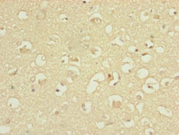 Polyclonal Rabbit anti-Human ATP5H Antibody (IHC, WB)