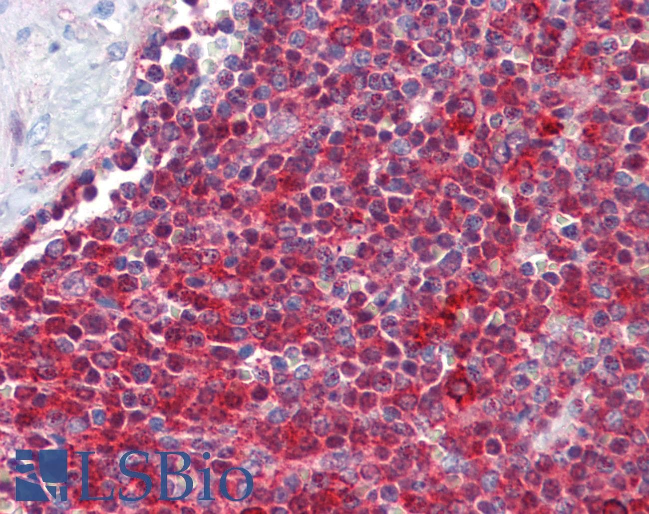 IHC-plus™ TNFRSF4 / CD134 / OX40 Antibody (N-Terminus)