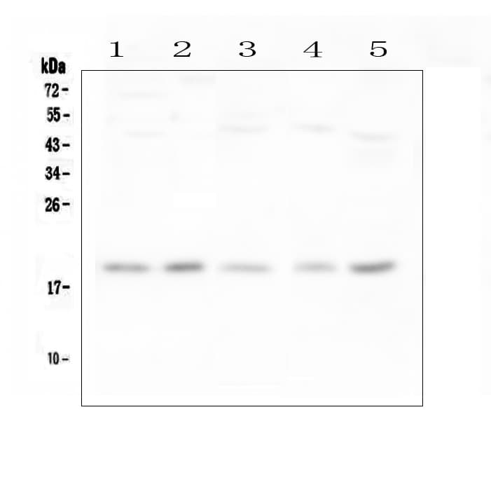 IFN Gamma / Interferon Gamma Antibody