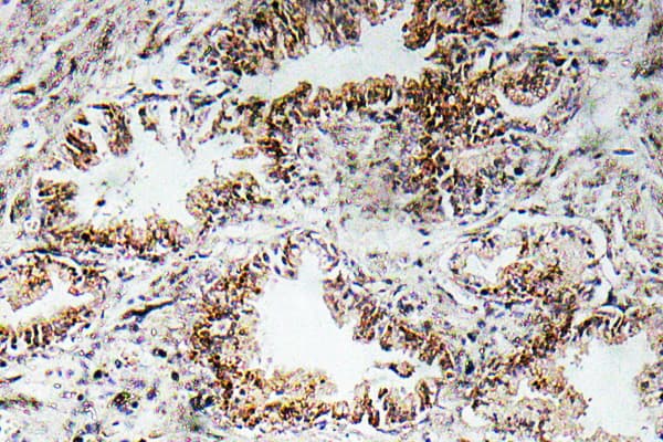 Polyclonal Rabbit anti-Human CHRNA1 Antibody (Glu217, IHC)