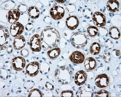 IFT57 / HIPPI Antibody (clone OTI2G3)