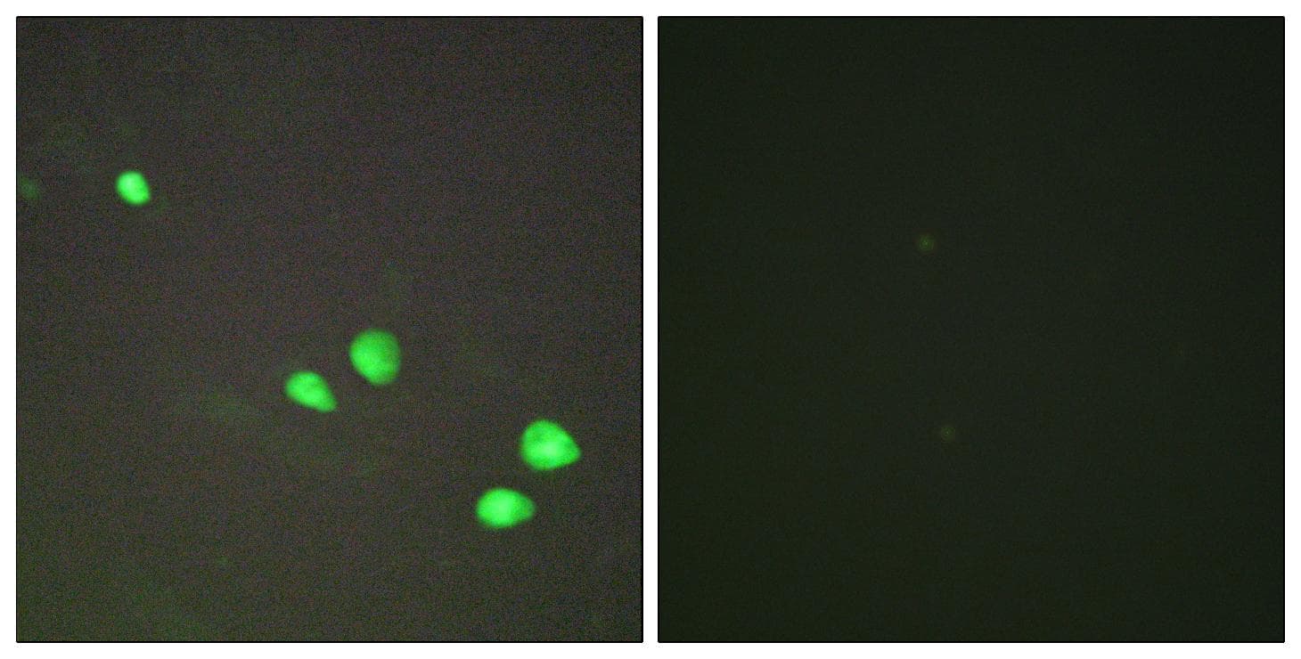 Polyclonal Rabbit anti-Human CHD4 Antibody (IHC, IF)