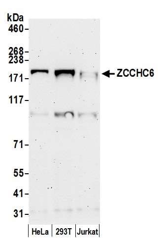 Polyclonal Rabbit anti-Human ZCCHC6 Antibody (aa800-850, WB)