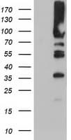 PFKP Antibody (clone OTI1D6)