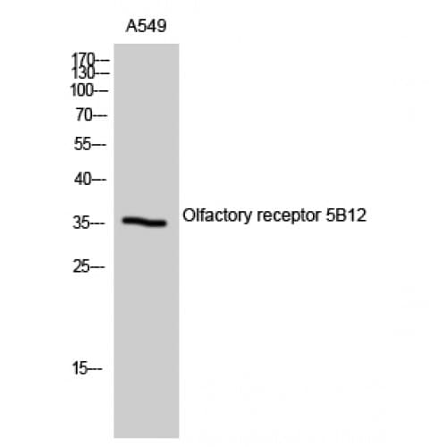 OR5B12 Antibody (170-250 aa, Internal)