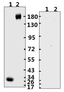 SARS-CoV-2 Spike Glycoprotein Antibody (ECD/RBD)
