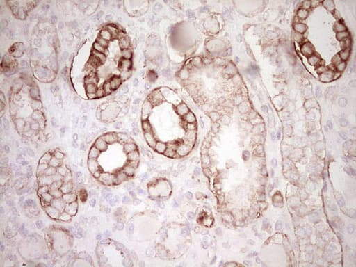 Monoclonal Mouse anti-Human Peripherin Antibody (clone OTI2D5, IHC, WB)