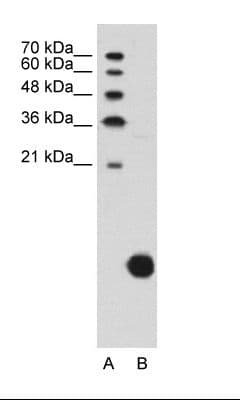 Polyclonal Rabbit anti-Human RPS29 / Ribosomal Protein S29 Antibody (C-Terminus, WB)