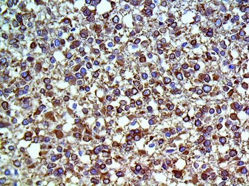 MAPT / Tau Antibody