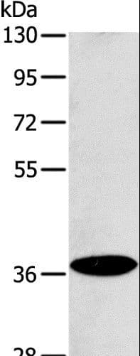 ACMSD Antibody