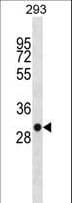 SDHB Antibody (aa205-234)