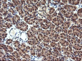 MAP2K1 / MKK1 / MEK1 Antibody (clone OTI1A10)