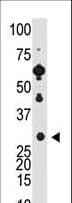 Recoverin Antibody (aa169-200)