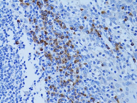 Polyclonal Rabbit anti-Human Apg7 / ATG7 Antibody (IHC, WB)