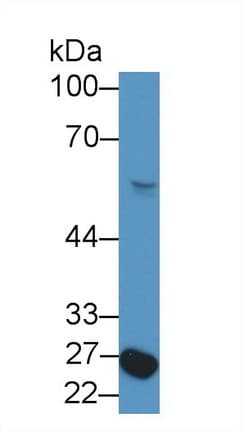 NF1A / NFIX Antibody (aa13-298, Biotin)
