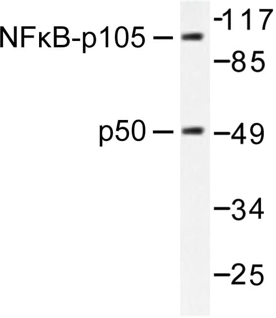 Polyclonal Rabbit anti-Human NFKB1 / NF-Kappa-B Antibody (Gln332, IHC, IF, WB)