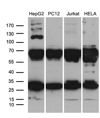 RPL10A Antibody (clone OTI4B2)