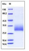 Mouse KLRB1 / CD161 Protein (Recombinant His,N-terminus)