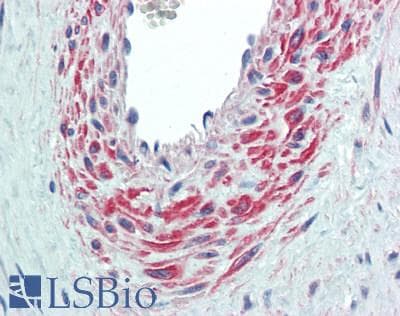 IHC-plus™ DHRS9 Antibody