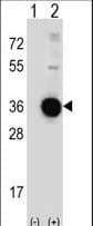 Polyclonal Rabbit anti-Human DDIT4 / REDD1 Antibody (aa198-227, IHC, WB)
