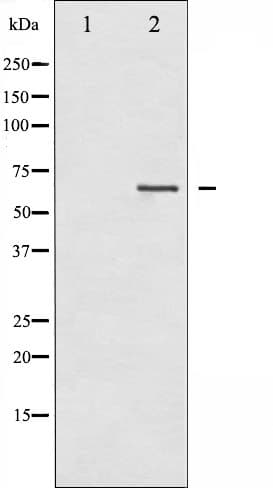 LIMK2 Antibody (phospho-Ser283)