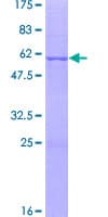 Human SNF8 / EAP30 Protein (Recombinant GST)