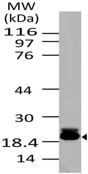 Polyclonal Rabbit anti-Human BIRC5 / Survivin Antibody (WB)